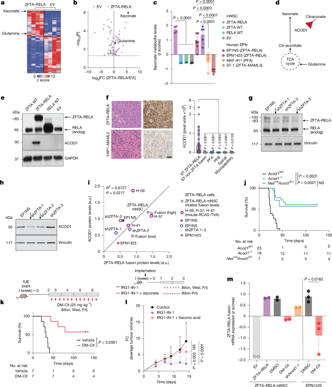 Fig. 1: ZFTA–RELA induces itaconate production and ACOD1 inhibition suppress tumour growth.