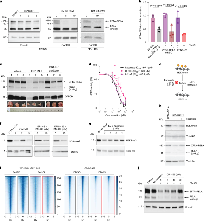Fig. 2: Inhibition of ACOD1 reduces global H3K4me3 and decreases pathogenic ZFTA–RELA levels.
