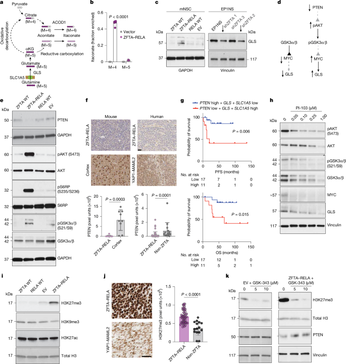 Fig. 4: ZFTA–RELA epigenetically suppresses PTEN and drives glutamine metabolism to generate itaconate.