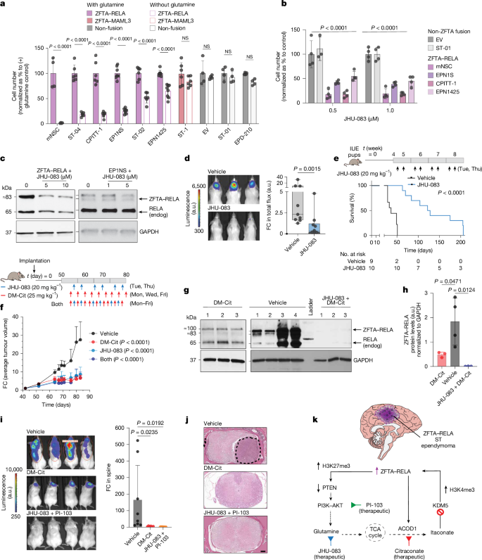 Fig. 5: Targeting glutamine metabolism leads to therapeutic effects in ZFTA–RELA ependymomas.