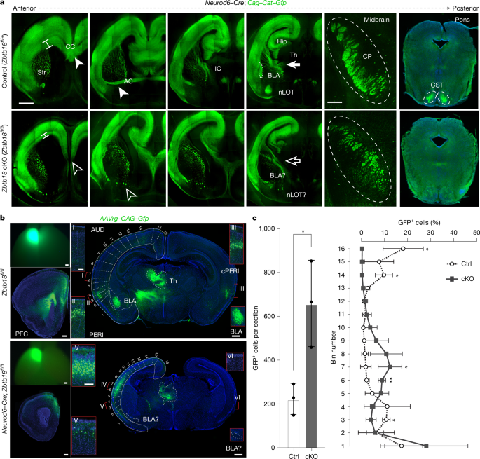Fig. 3: ZBTB18 depletion reduces callosal and subcerebral projections while increasing cortico-cortical association projections.