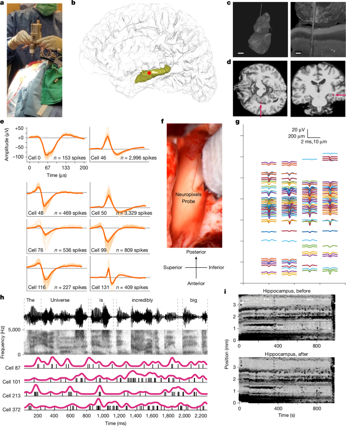 Fig. 1: Neuropixels implantation procedure and analysis.
