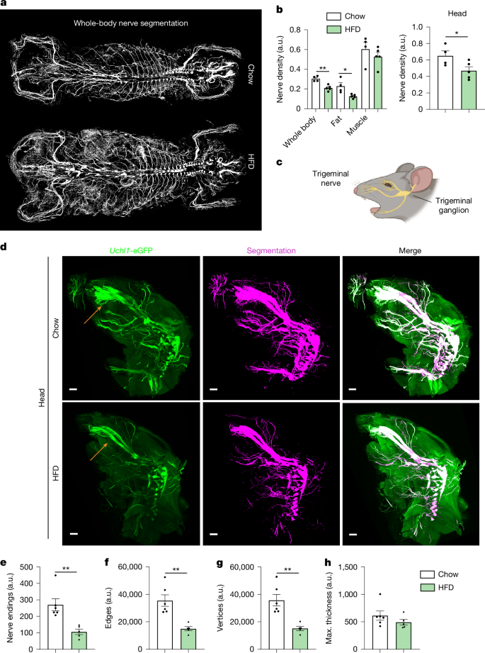 Fig. 3: Whole-body nerve segmentation reveals structural changes in the infraorbital nerve in obesity.