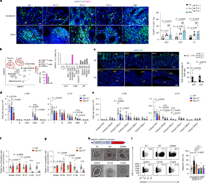 Fig. 2: GPR15 regulates CD8α+ T cell migration to colon.