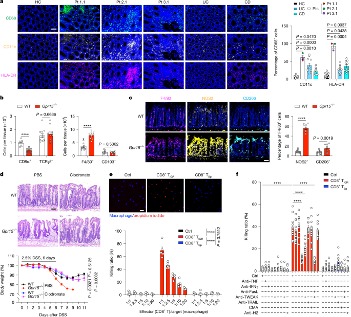 Fig. 5: Macrophages that accumulate in colitis can be killed by CD8+ TIGR cells by death receptor signalling.