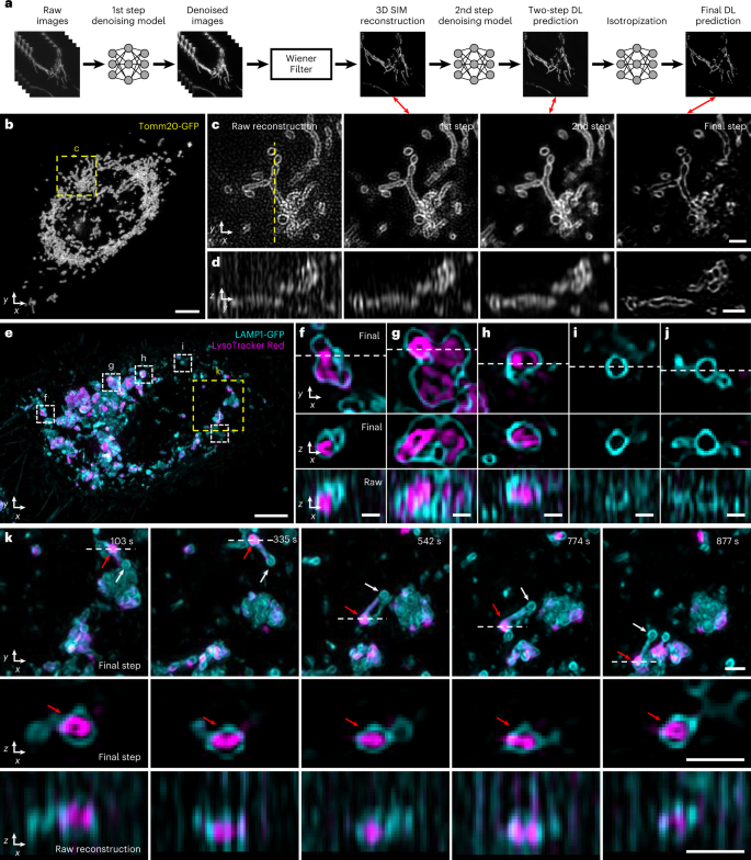 Fig. 5: Denoising and axial resolution enhancement facilitate 4D super-resolution imaging with isotropic resolution.