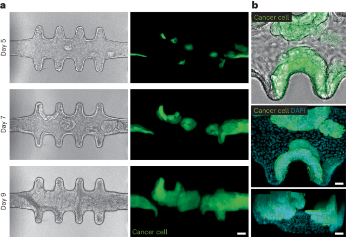 Next-generation Patient Models For Colorectal Cancer Research 