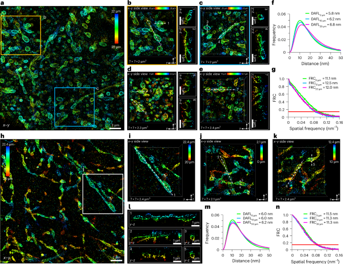 Fig. 6: me4Pi-SMLM imaging in brain slices.