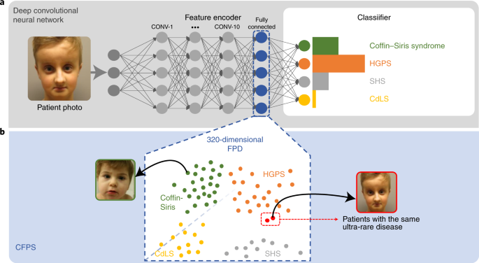 Facial Phenotyping by GestaltMatcher
