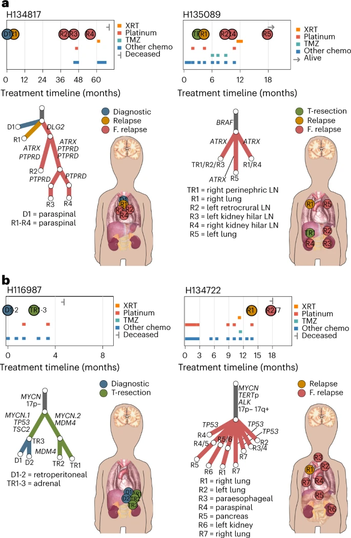 Clonal evolution during metastatic spread in high-risk neuroblastoma