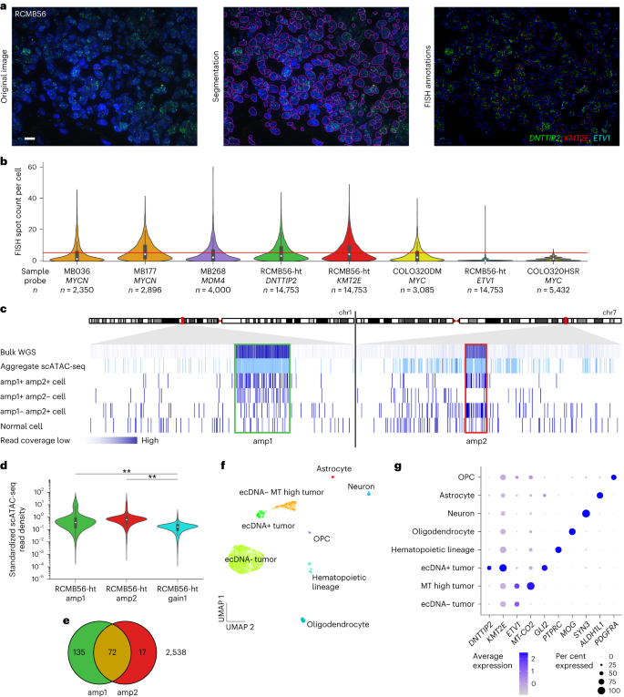 Fig. 3: Single-cell analysis reveals a distinct tumor cell population with high-copy ecDNA amplification.