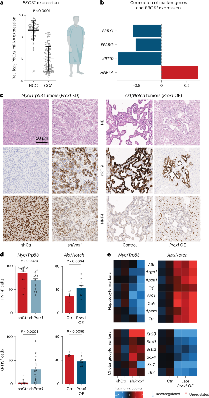 Fig. 7: PROX1 regulates HCC versus CCA fate trajectories.