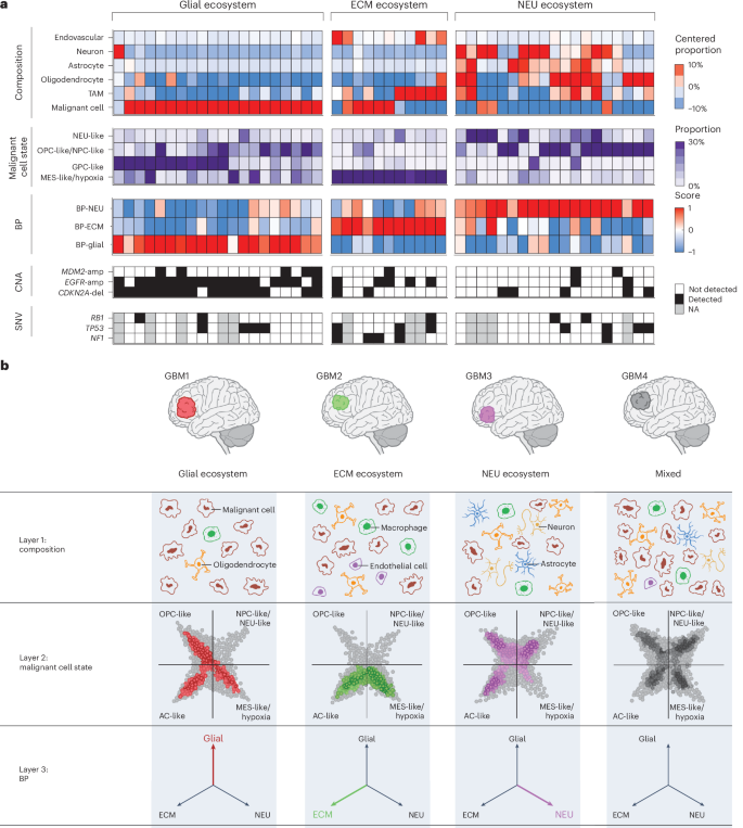 Fig. 6: Stereotype transcriptomic architectures in GBM.
