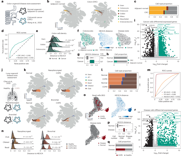 Fig. 7: Comparison with the HEOCA healthy organoid cohort reveals disease-associated features.