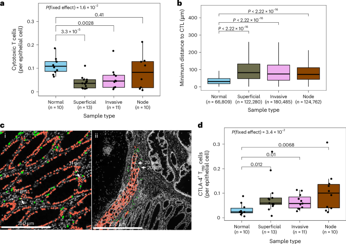 Fig. 3: Immune exclusion and clonal immune escape in CRCs.