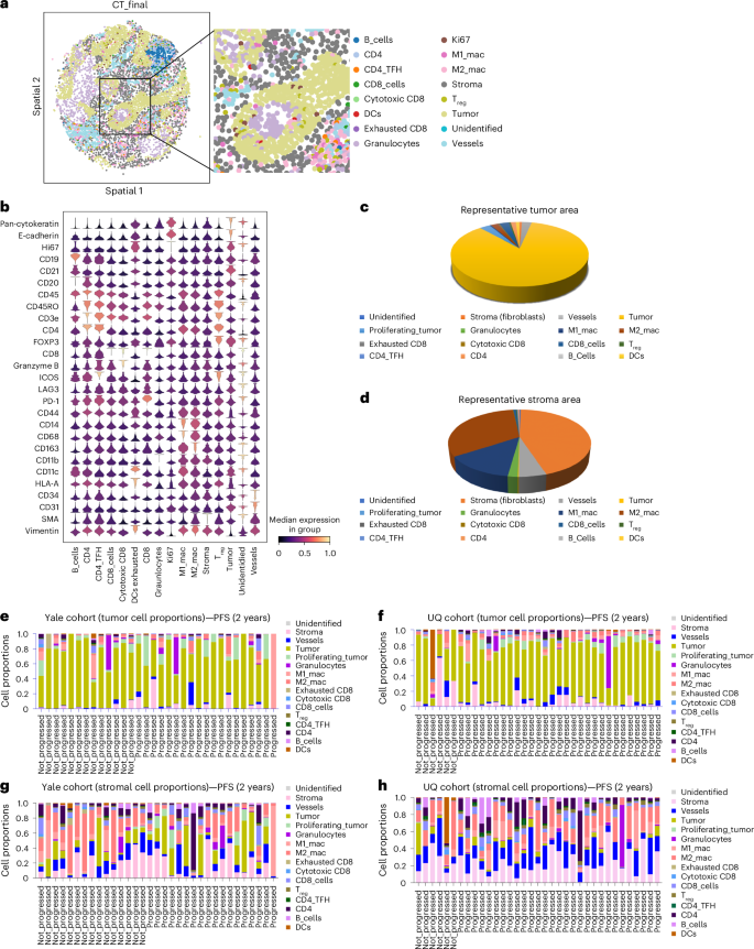 Fig. 2: Cell-type and composition of tumor and stroma compartments.