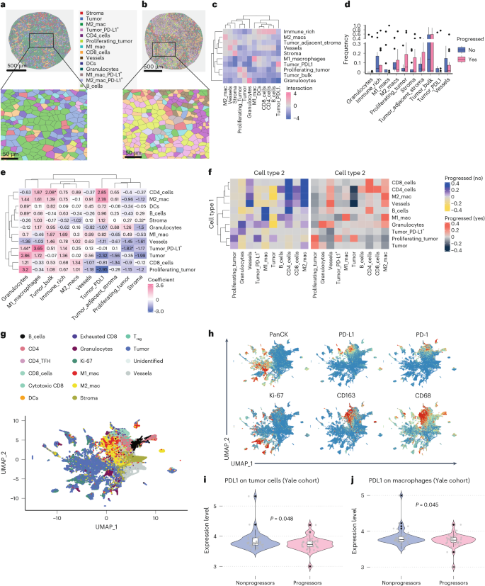 Fig. 4: Spatial analysis of cellular neighborhoods and immune cell interactions in the TIME.