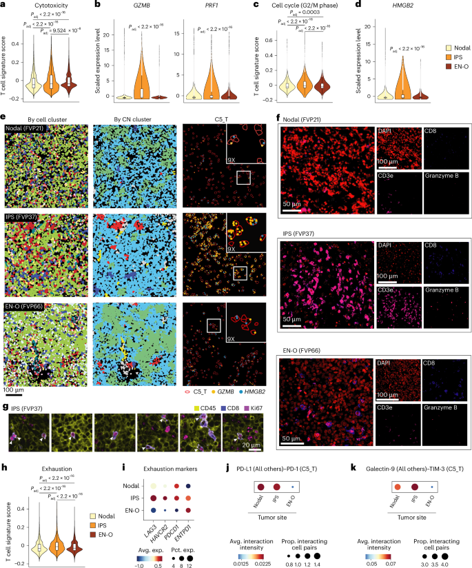 Fig. 7: Spatial characteristics of lymphomas of IPS.