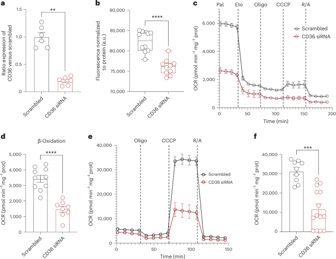 Fig. 4: Effect of CD36 knockdown on fatty acid uptake and mitochondrial function in human CMs.