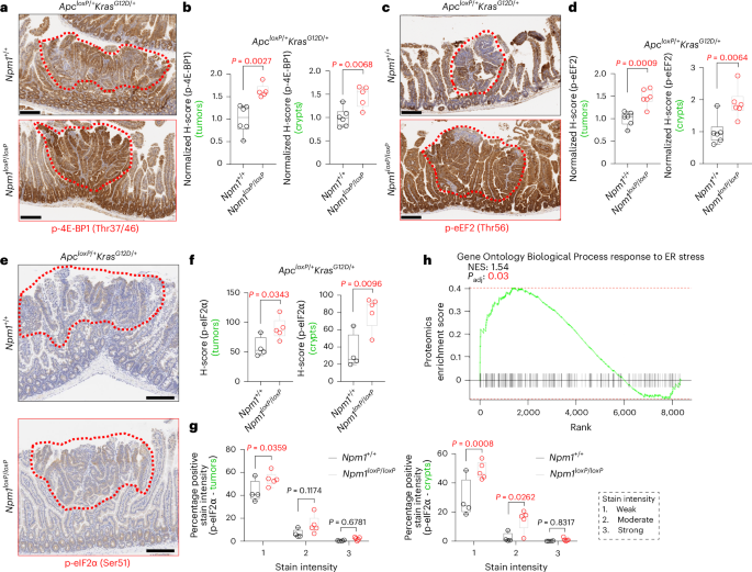 Fig. 5: NPM1 loss induces protein synthesis stress.