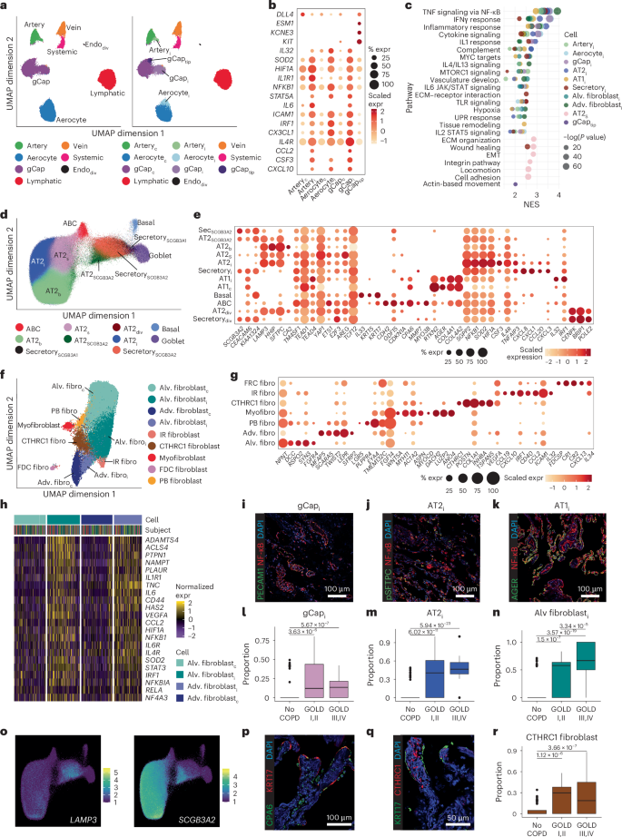 Fig. 1: Cellular shifts in endothelial, epithelial and fibroblast populations in COPD.