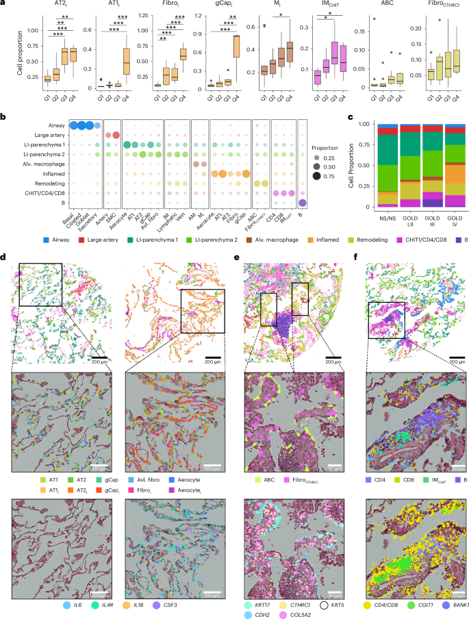 Fig. 5: Aberrant cellular communities observed within spatially resolved niches.