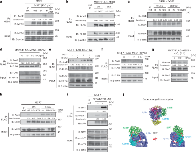 Fig. 2: MED1 IDR deacetylation is induced by multiple stresses and regulated by SEC-associated SIRT1.