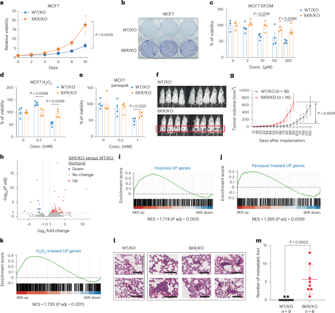 Fig. 6: ER+ BC cells with the acetylation-defective 6KR mutant MED1 exhibit enhanced tumorigenesis and tolerance to hypoxic and oxidative stresses.