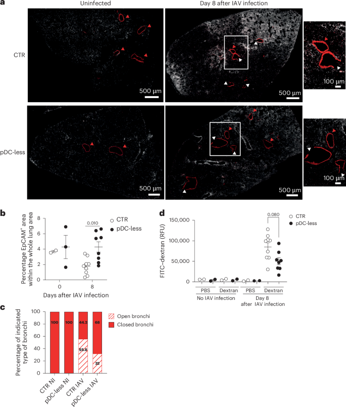 Fig. 7: During IAV infection lung integrity and permeability are less affected in the absence of pDCs.