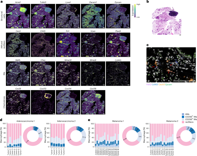 Fig. 3: Compartmentalized IM and recMac populations organize chemokine landscapes in lung adenocarcinoma.