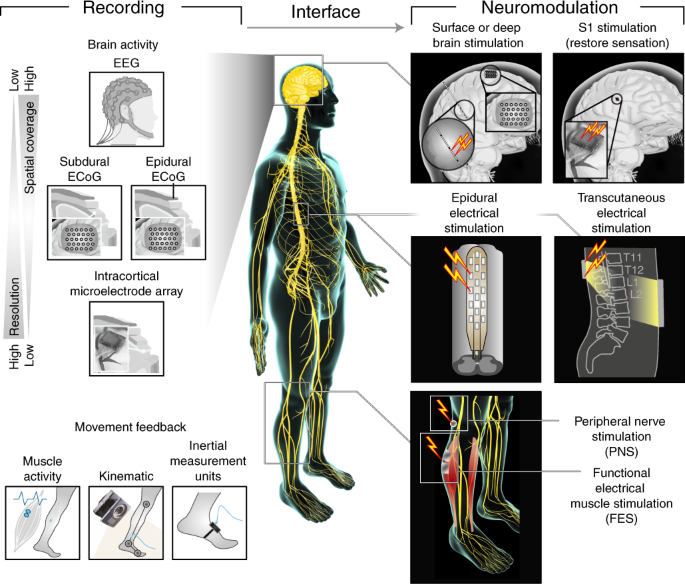 Spinal cord repair: advances in biology and technology | Nature Medicine