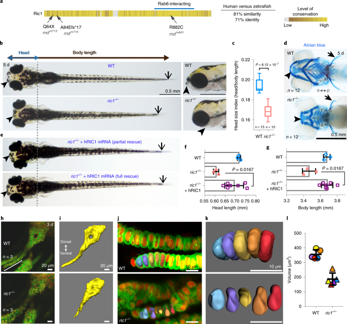 Phenome-based approach identifies RIC1 -linked Mendelian syndrome through  zebrafish models, biobank associations and clinical studies | Nature  Medicine