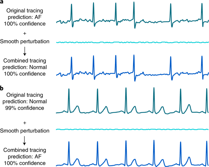 apple watch ecg examples