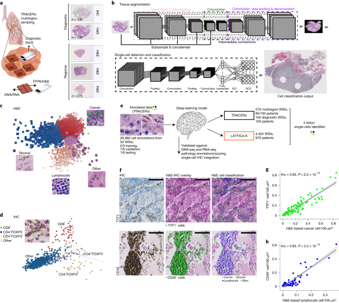 Geospatial Immune Variability Illuminates Differential Evolution Of Lung Adenocarcinoma Nature Medicine
