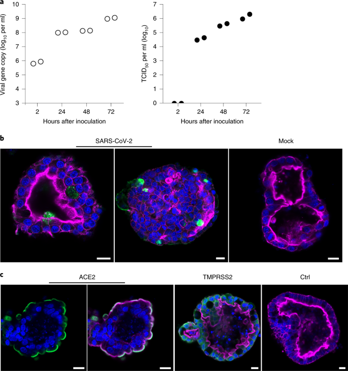 Infection Of Bat And Human Intestinal Organoids By Sars Cov 2 Nature Medicine