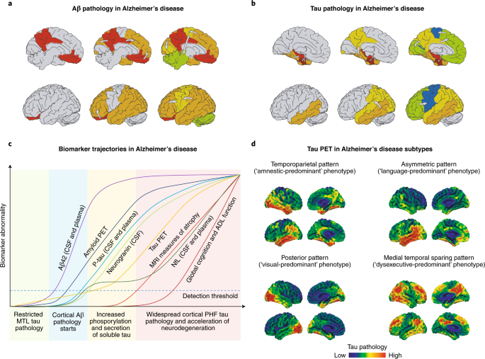 Biomarkers for neurodegenerative diseases | Nature Medicine