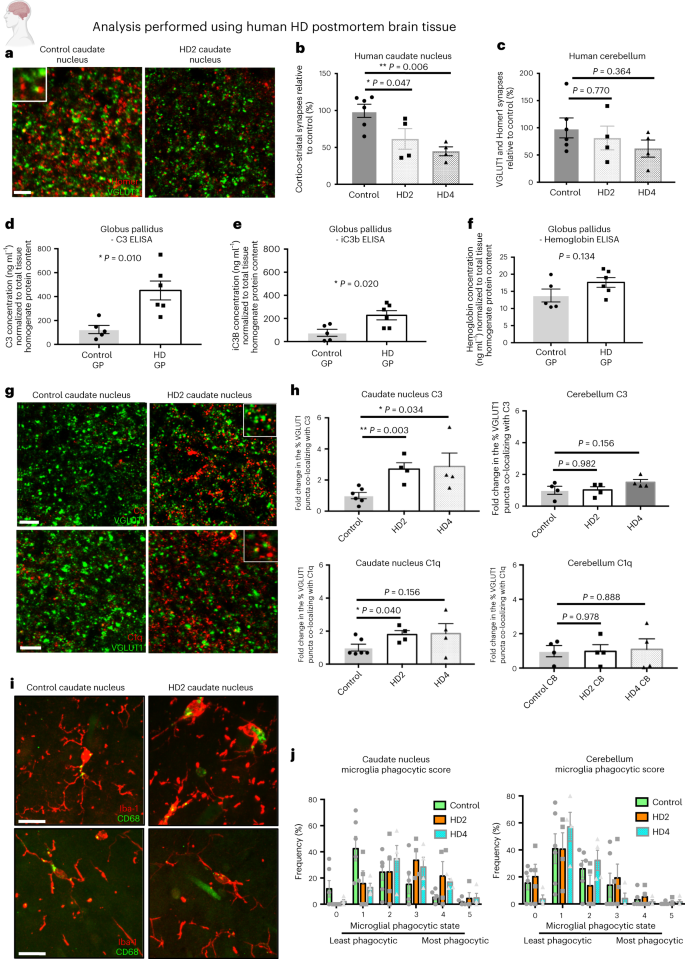 Fig. 1: Loss of corticostriatal synapses, increased activation and association of complement proteins with synaptic elements and adoption of a more phagocytic microglial state are evident in postmortem brain tissue from patients with HD.