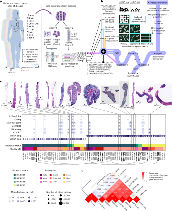 Fig. 1: Profiling of MBC biopsies using scRNA-seq, snRNA-seq and four spatial expression methods.