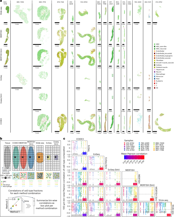Fig. 3: Spatial expression profiling of MBC biopsies.