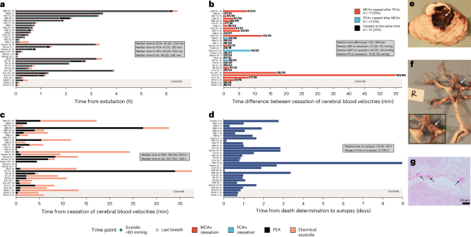 Fig. 1: Timing of physiology throughout the dying process until circulatory arrest with pathology correlates.