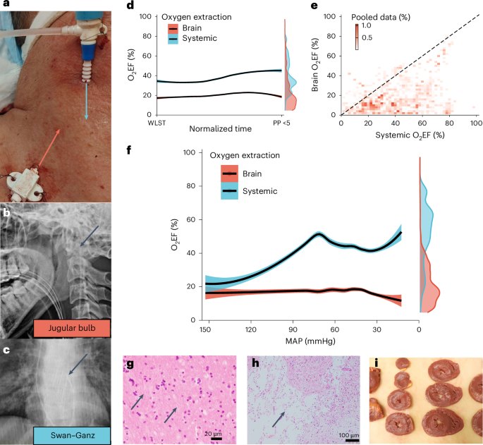 Fig. 4: Comparisons between brain and systemic O2EF in critically ill humans.
