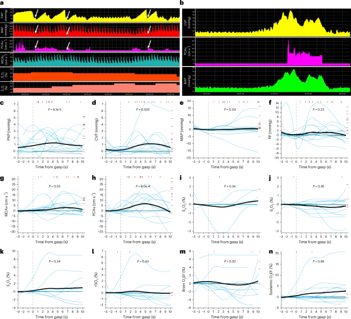 Fig. 6: Physiologic responses to the last agonal breath during the dying process in critically ill humans.