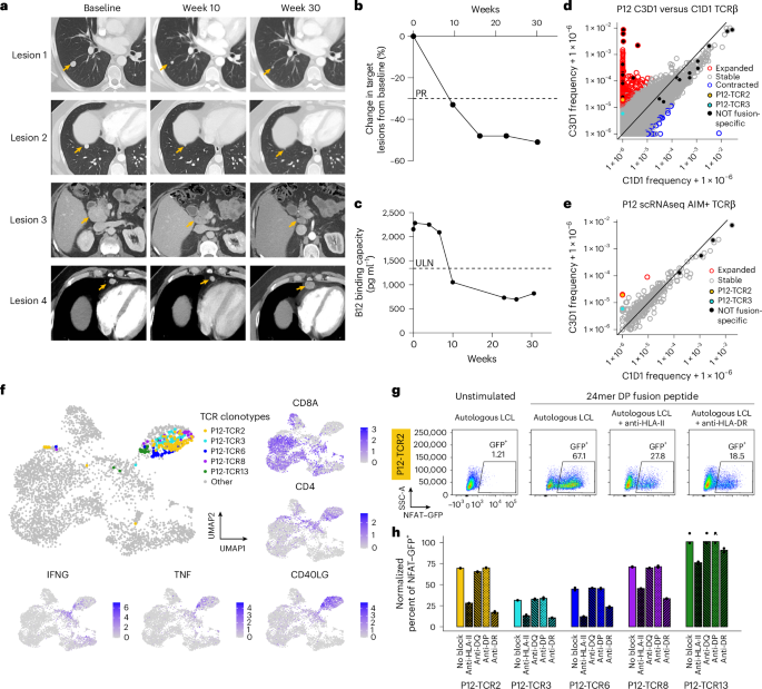 Fig. 3: T cell responses to diverse DNAJ-PKAc neoepitopes in an exceptional clinical responder.