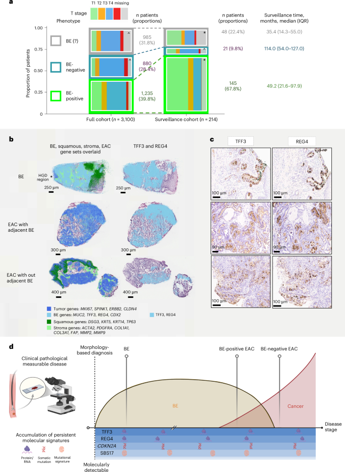 Fig. 5: Clinical surveillance patterns and BE lineage biomarker spatial analysis in EAC samples.