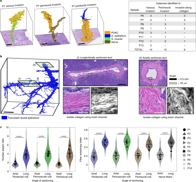 CODA: quantitative 3D reconstruction of large tissues at cellular  resolution | Nature Methods