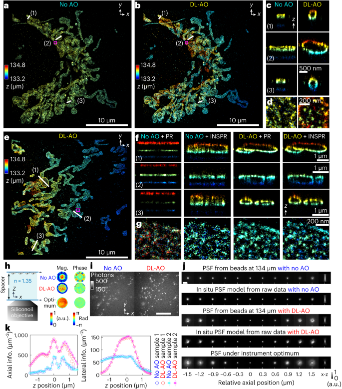 Fig. 3: Demonstrations of DL-AO correcting index mismatch-induced aberration by imaging Tom20 proteins in COS-7 cells through 134-μm water-based imaging media.