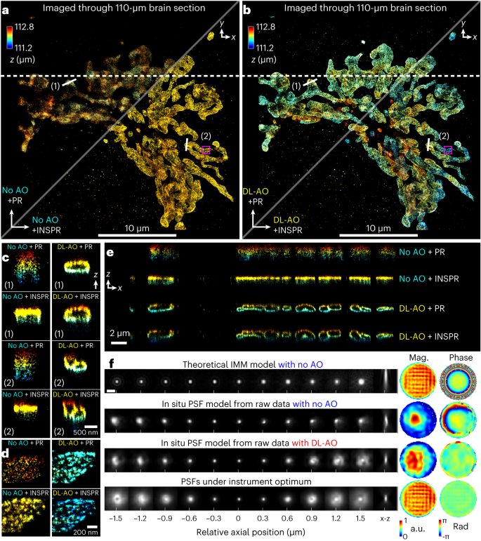 Fig. 4: Demonstrations of DL-AO correcting sample-induced aberrations by imaging Tom20 proteins in COS-7 cells through 110-μm unlabeled mouse brain section.
