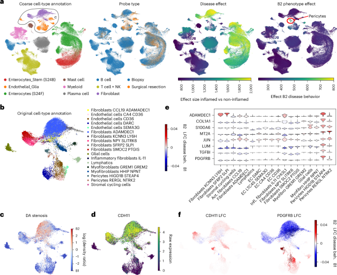 Fig. 5: Characterization of stenosis in Crohn’s disease.