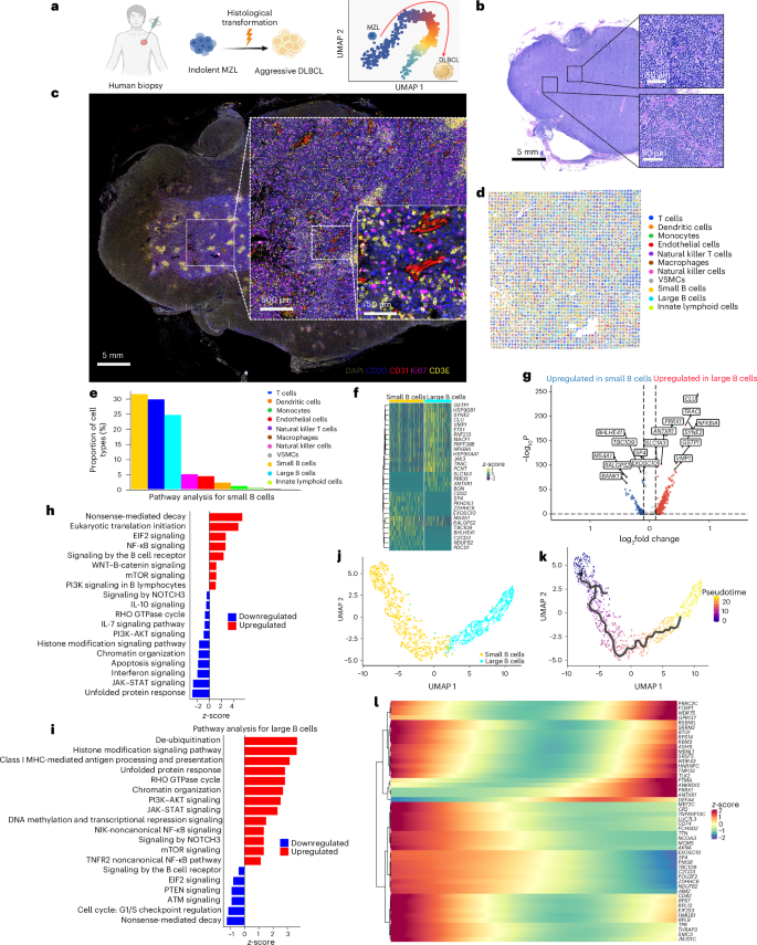 Fig. 4: Spatial multi-omic characterization of MZL.