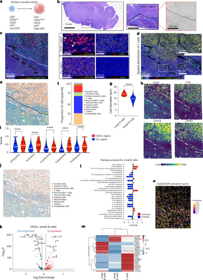 Fig. 5: Spatial multi-omics characterization of Richter’s transformation from CLL to DLBCL.